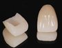 インプラントと天然歯の混在症例
